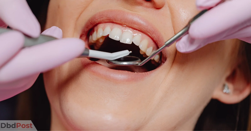 inarticle image-gum graft cost -What is a gum graft and when is it necessary_