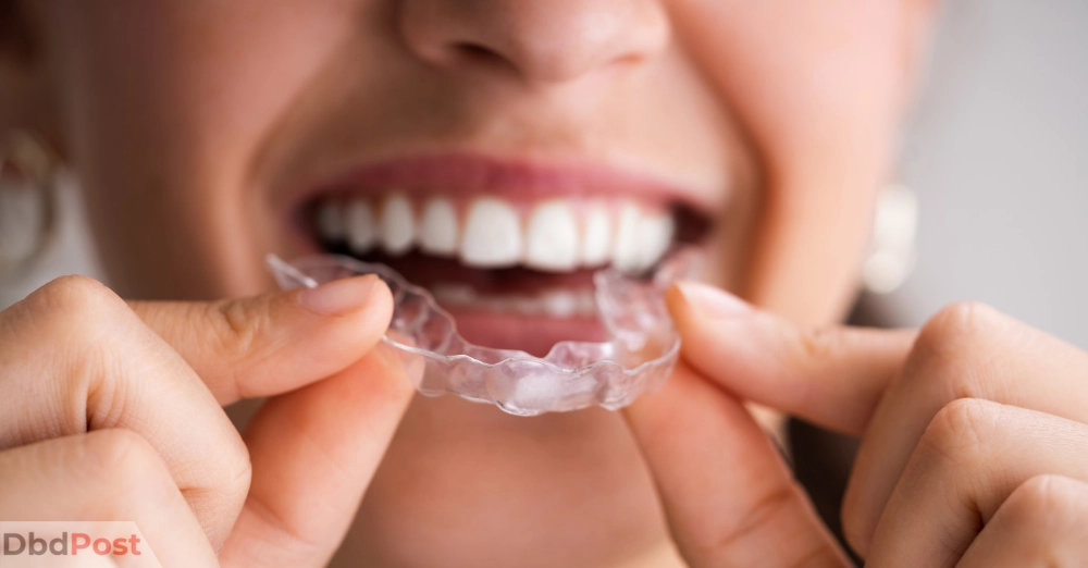 inarticle image-hybrid battery replacement cost -Clear Aligners