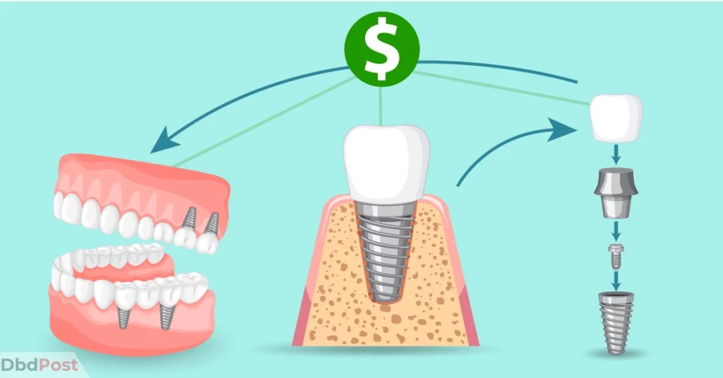 feature image-how much does a crown cost without insurance-teeth crown illustration-01