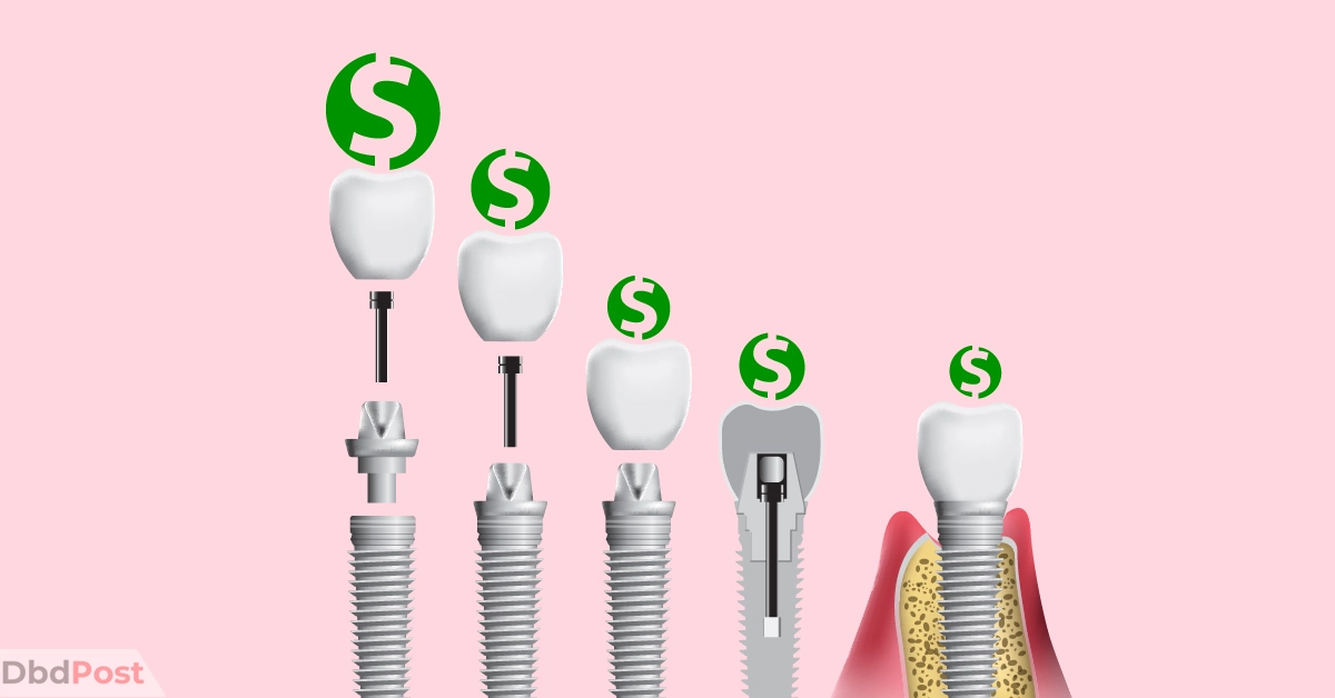 feature image-single tooth implant cost without insurance-tooth implant illustration-01