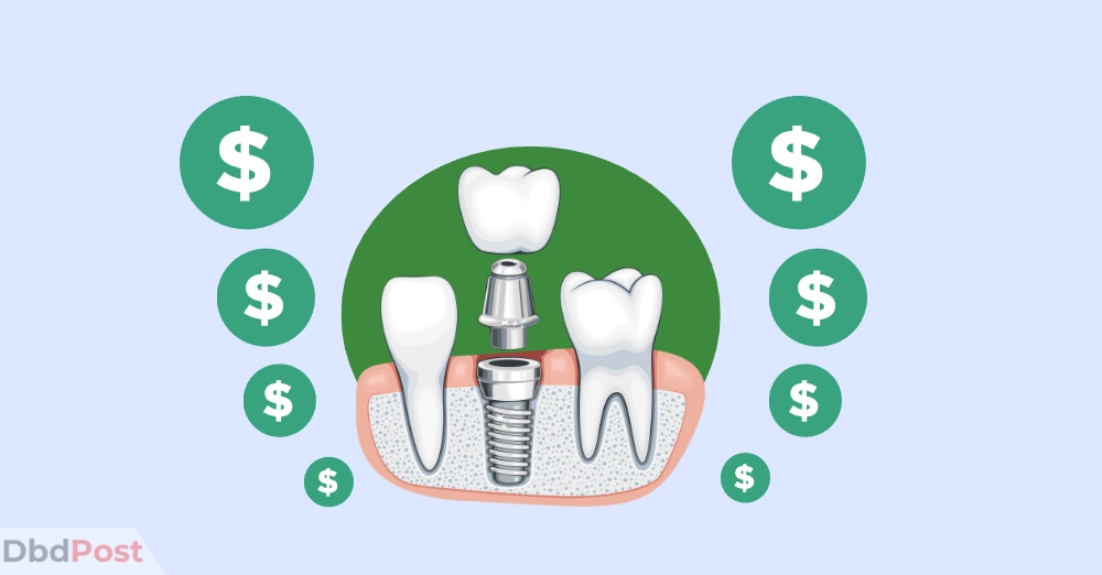 inarticle image-dental implant cost -Average cost of dental implant