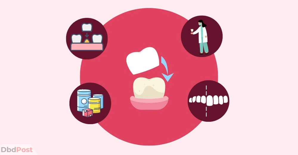 inarticle image-how much do veneers cost-The average cost of veneers