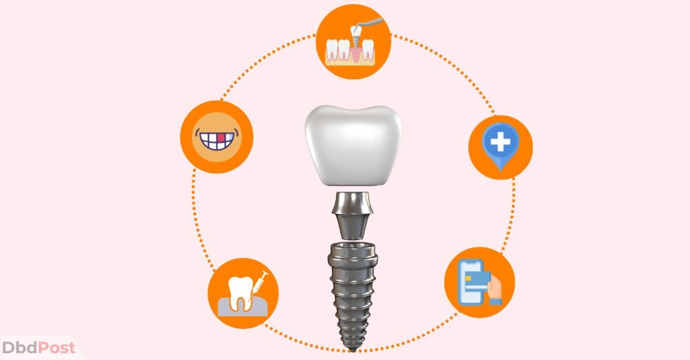 inarticle image-single tooth implant cost without insurance-Factors affecting single tooth implant cost without insurance