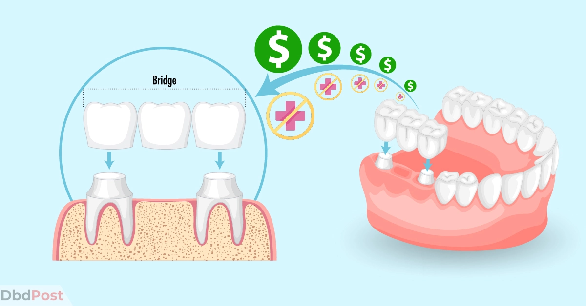 feature image-how much does a dental bridge cost without insurance-dental bridge illustration with dollar and no insurance icon-01