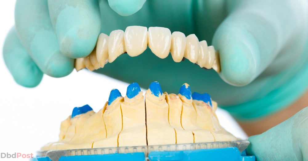 inarticle image-how much does a dental bridge cost without insurance-How much does a Dental Bridge cost without insurance